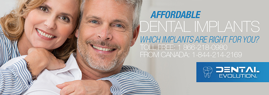dental implants cost mexico