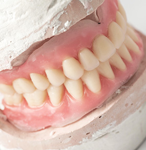 snap on dentures cancun